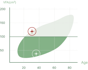 나이별 내장지방 분포에서 감량 전 133.5cm², 감량 후 36.4cm² 위치